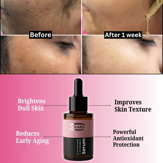Iguana Brightening Serum – 2% Glutathione + 2% Vitamin B3 for Radiant Skin